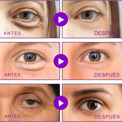 LumiPatch® Activos Potentes para Ojos Radiantes